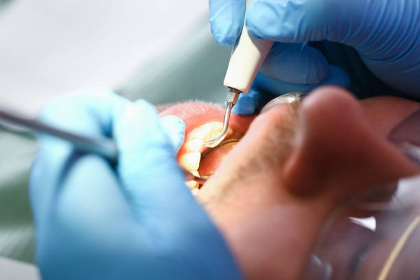 Best Emergency Dentist for Knocked-Out Tooth in Westland, MI